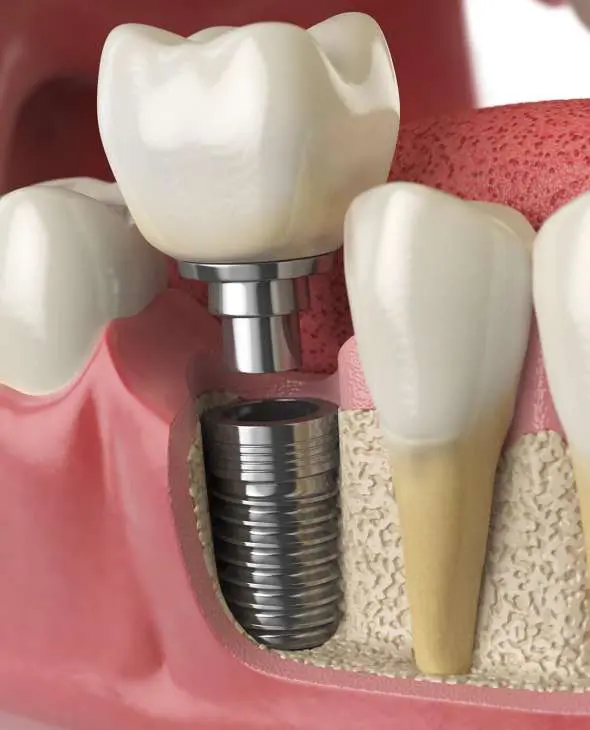 dentures Sydney