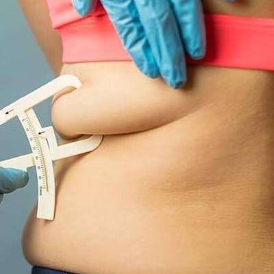 best liposuction in islamabad